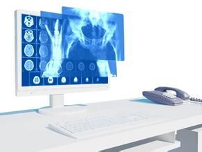 煙臺浩園軟件PACS系統(tǒng) 引領(lǐng)智慧醫(yī)療與健康養(yǎng)老新未來